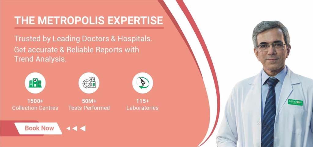 Metropolis expertise logo